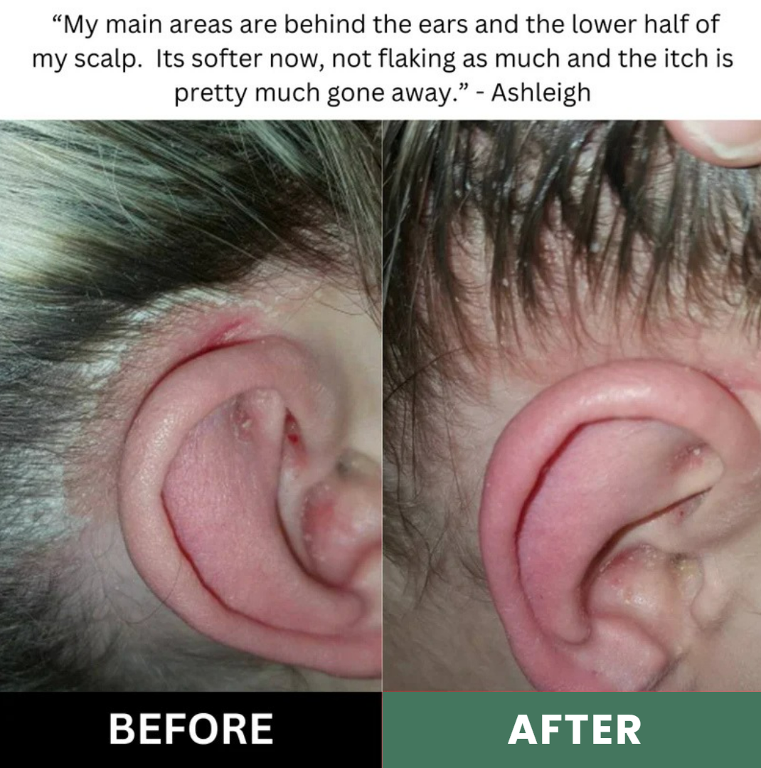 Lissima Natural Scalp Scrub