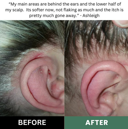 Lissima Natural Scalp Scrub