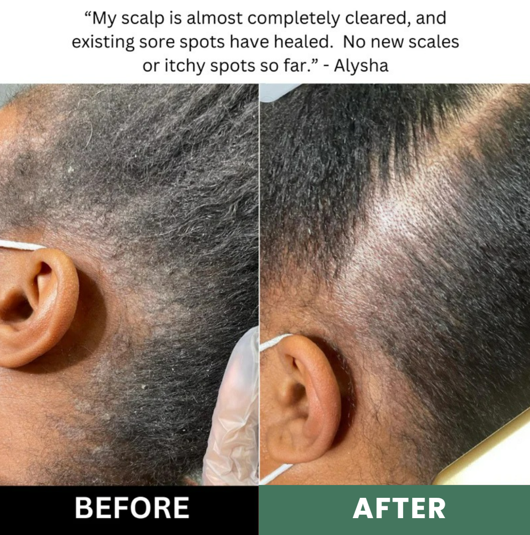 Lissima Natural Scalp Scrub
